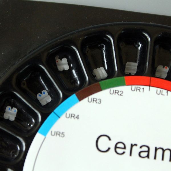 Mbt 022 Ceramic Dental Bracest Lower Friction Force For Orthodontic Treatment