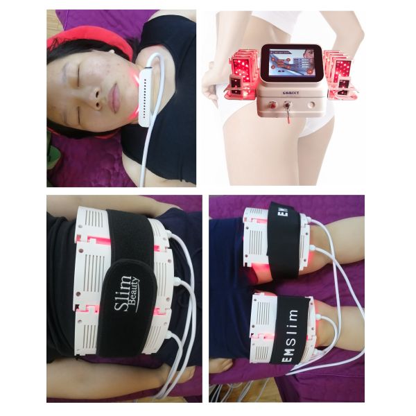 Горячая продаваемая машина потери веса терапией лазерного луча оборудования 5Д лазера диода быстрая уменьшая