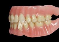 Dentes de arco completo acrílico acessíveis para dentes removíveis confortáveis