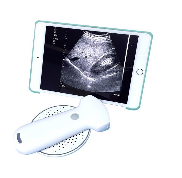 Affordable Ultrasound Equipment Wireless Convex Array Medical Probe MSLPU94