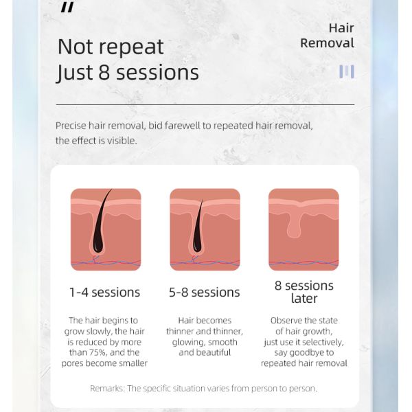 Ледовый охлаждающий 808 диодный лазерный эпилятор Трехволновый эпилятор