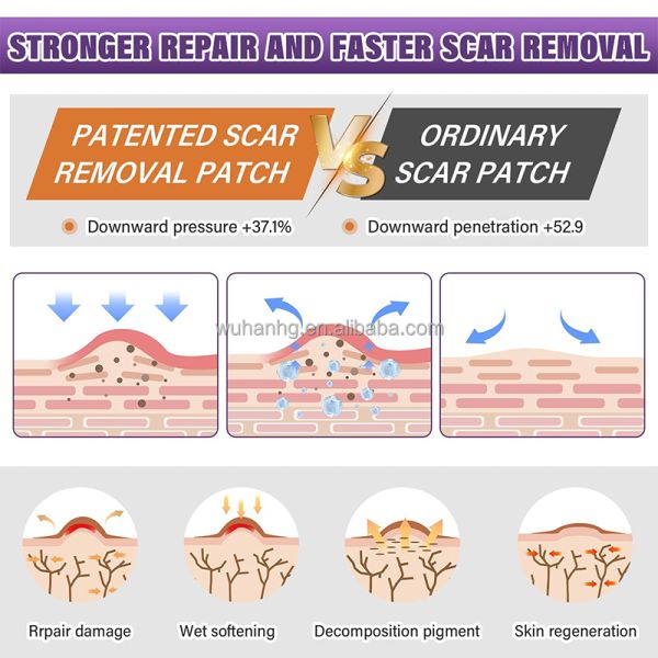 Custom Printed Cute Colorful Silicone Gel Sheet Roll Rehabilitation Therapy Patches