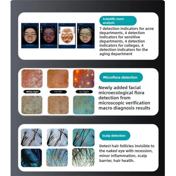 21.5 Inch 3 Cameras Hair Follicles Scalp Scanner Detector Facial Skin Analyzer Machine