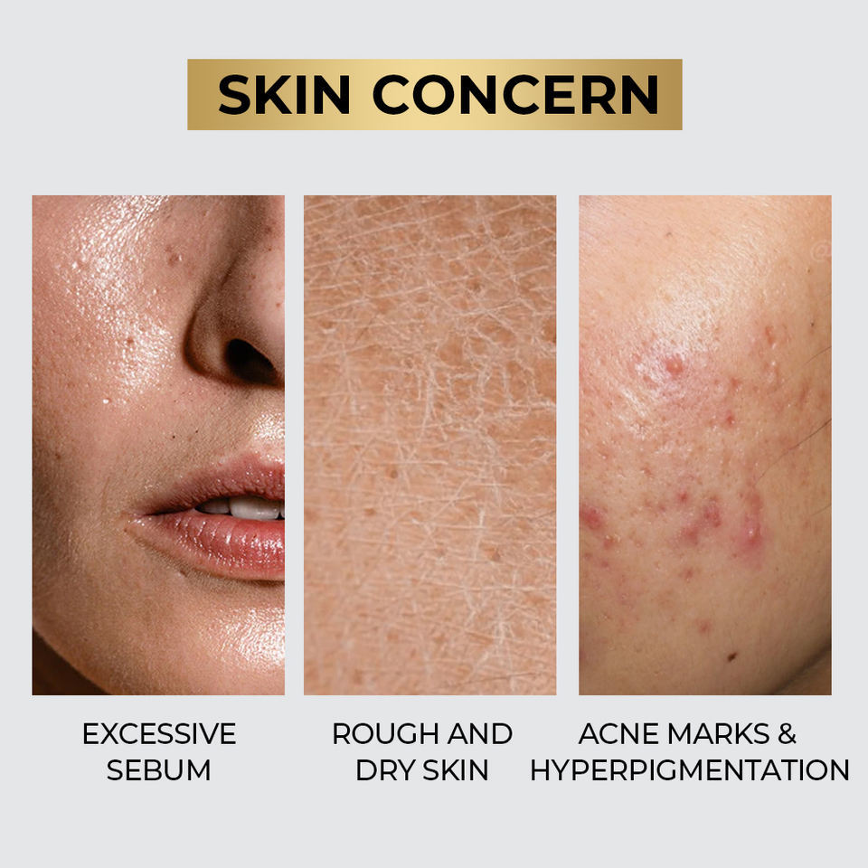 OEM ODM Brand ExosomeFacial Serum essence Nicotinamide Anti aging Acne Control Centella B5 AHA+BHA+PHA Pore Shrinkage Oil Skin Care Serum