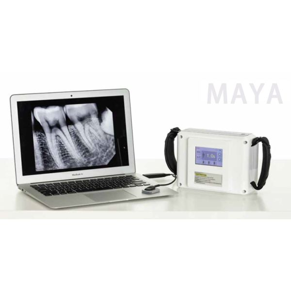 Radiología Dental Digital X Ray Equipment Maquina Equipo De Rayos X Portatil