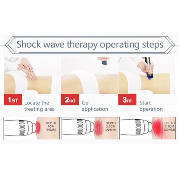 Acoustic Shock Wave Physical Therapy Equipment For Back Pain Relief