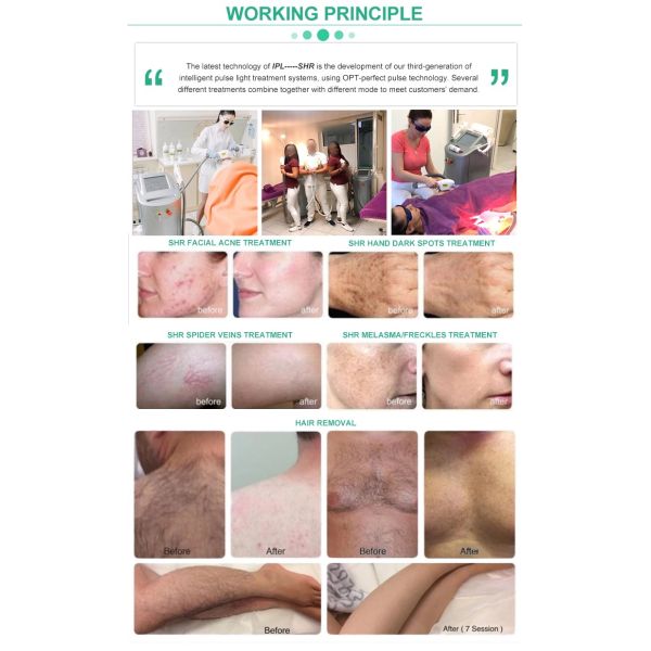 Beauty Salon Ipl Hair Removal Device / Shr Ipl Machine For Skin Rejuvenation