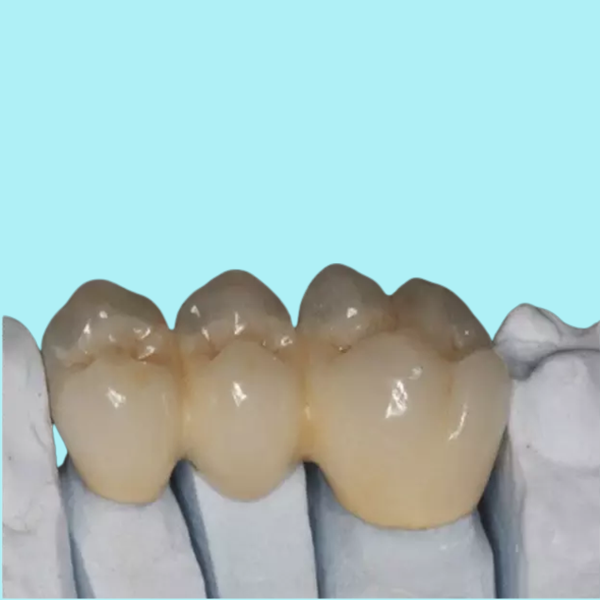 Подгонянное OEM красивое зубов фарфора Zirconia высокопрочное прочное
