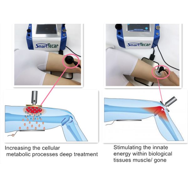 Глубокая нагревая машина терапией Tecar массажа для боли тела