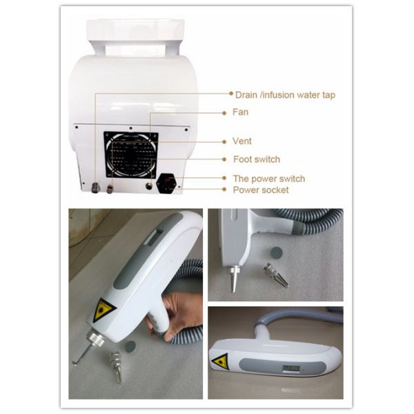 Q Switch Yag Лазерная машина для удаления татуировок 400 Вт Уход за кожей Красотное оборудование