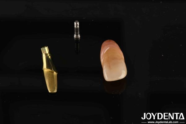 0° Angulation Finished Dental Abutments 1.5mm Thread Pitch Polished Surface
