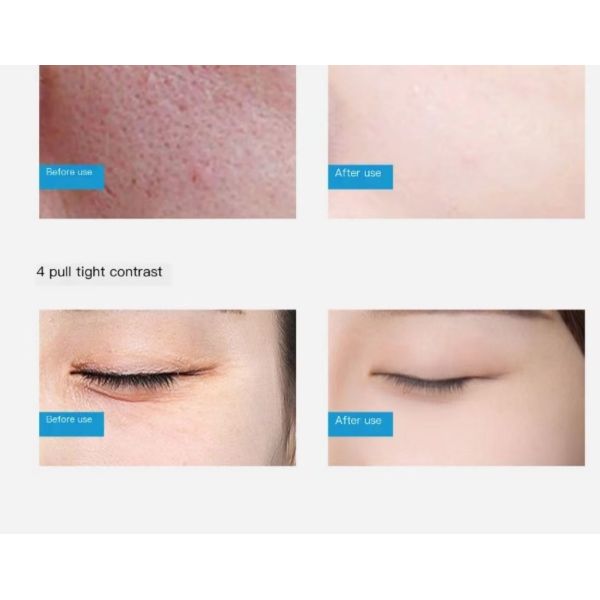 Aqua кожи машины красоты гидры перевозчика угорь лицевой глубоко очищая 14 в 1