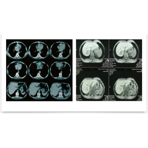 чернила принтера чернил струйного принтера 70ml L130 L805 L1300 L1800 Xp2100 Xp3100 Xp4100 Epson