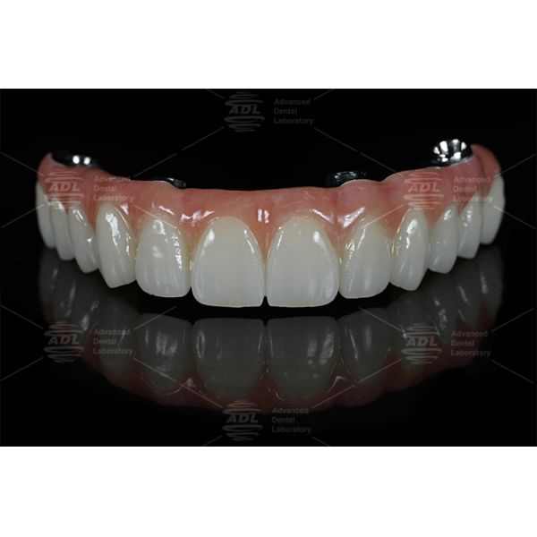 China Dental Lab Fast Turnaround Time In 72 Hours Provides High Quality All on X