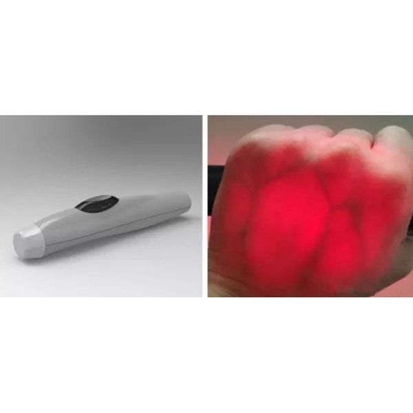 Vascular Projection Infrared Vein Finder Safe Light Source No Pressure