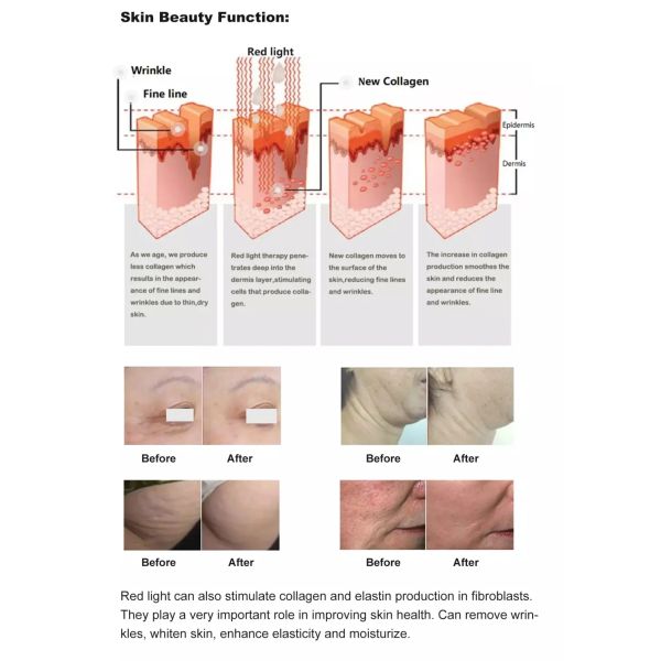 Терапия 880nm 660nm красного света машины терапией фотона пользы лошади кота собаки