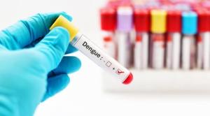 Do anticorpo aprovado do jogo do teste do antígeno da dengue Ns1 do CE gaveta r