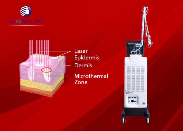Globalipl New Portable CO2 Fractional Laser Machine For Acne Removal And Skin Tightening