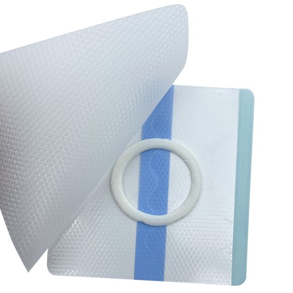 Skin Friendly Breathable Clear Wound Dressings for Baby's Navel Neonatal Hip Hernia