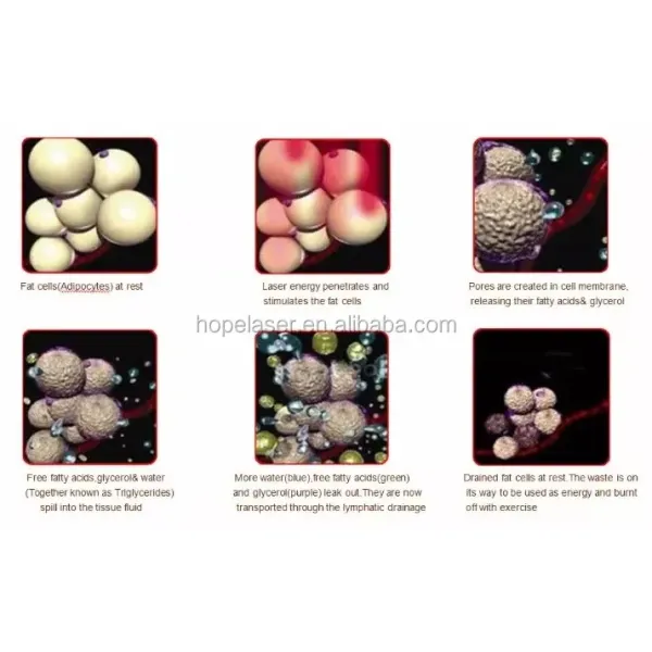 High quality 8 Pads Diode Lipo Laser LLLT Ultrasonic 40K Cavitation Slimming Vacuum RF Cellulite Weight Loss Machine