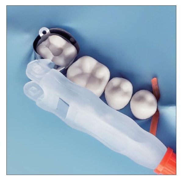 Class 2 Matrix Retainers And Bands Dental Use M5 1.0