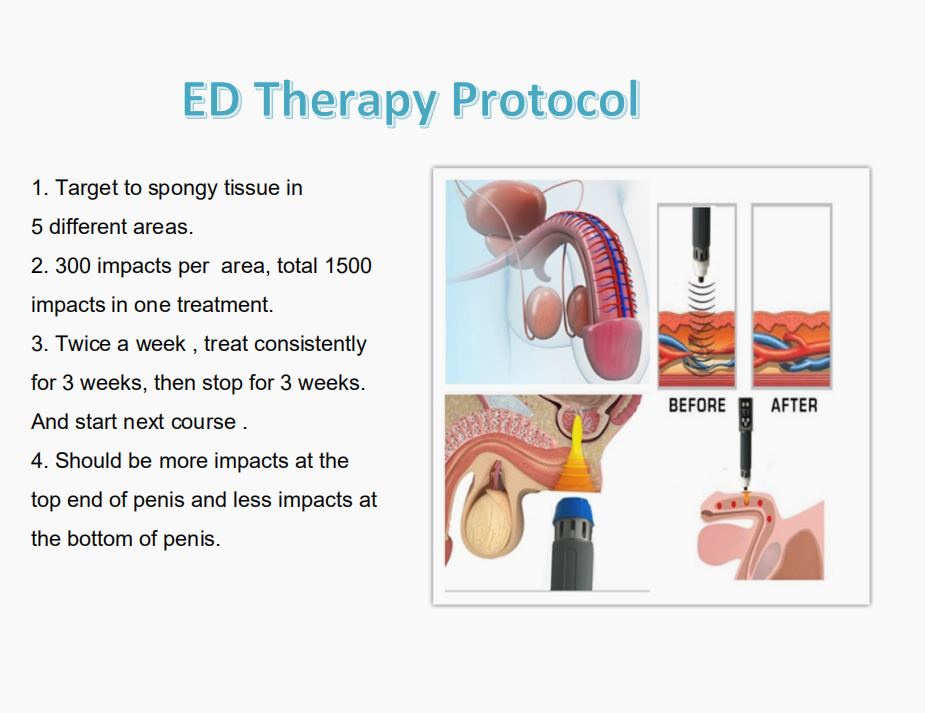 Оборудование для терапии ударными волнами ABS Пулсирующее электромагнитное поле