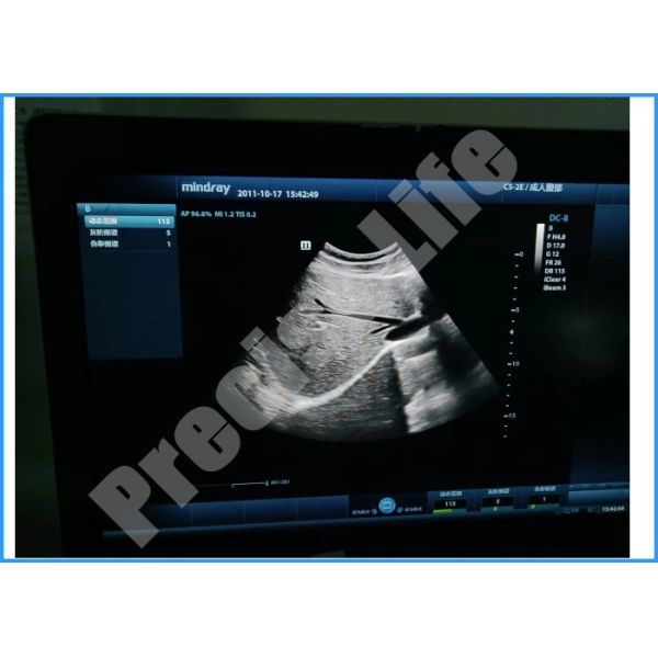 Датчик зонда ультразвука Mindray C5-2E выпуклый для машины DC 8