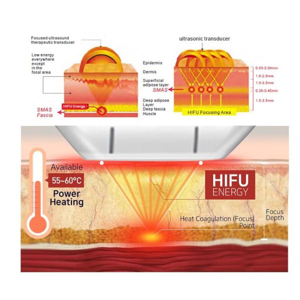 Home Use 2D HIFU Facelift Machine , Portable Ultrasound Skin Tightening Machine
