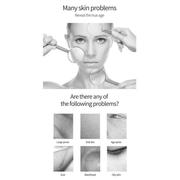 Hydra microdermoabrasión hidrodermoabrasión aqua facial jet peel máquina equipo de belleza