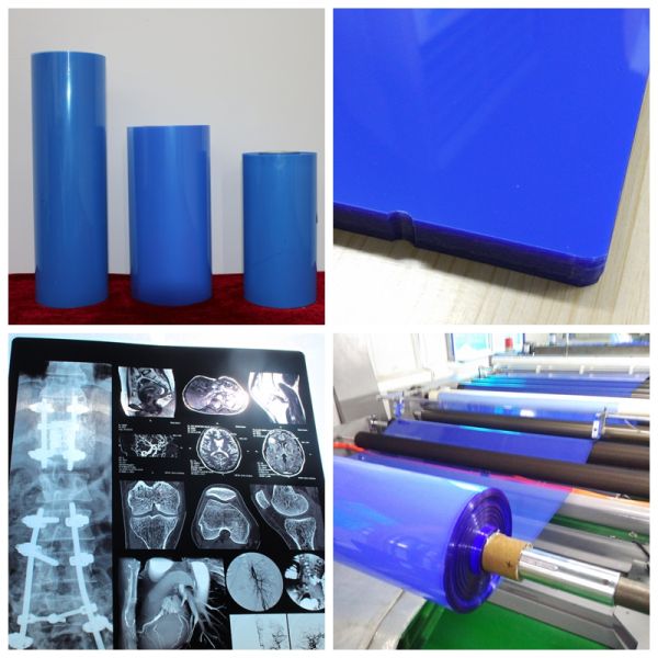 8x10 Inch 14x17 Inch Medical X Ray Film MRI PET CT Scan Films