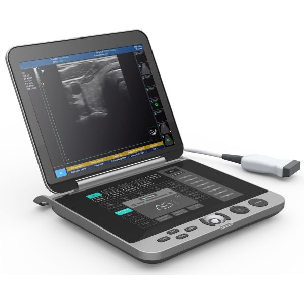 High Resolution Laptop B/W Ultrasound MSK Ultrasound Scanner Laptop Ultrasound Machine