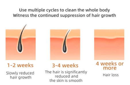 1200 nm Skin Rejuvenation IPL Hair Removal Device 120J/CM2 Energy