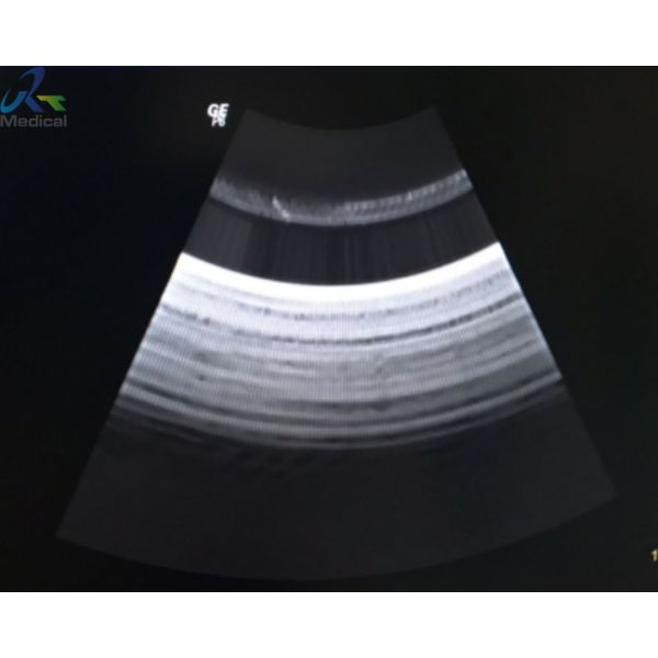 GE Logiq P6 5212114-3 Ultreasound Repair Service Ultrasound Machine Board