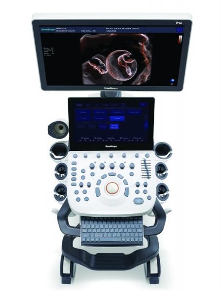 21.5'' LED Sonoscape P10 Trolley Color Doppler Ultrasound Machine