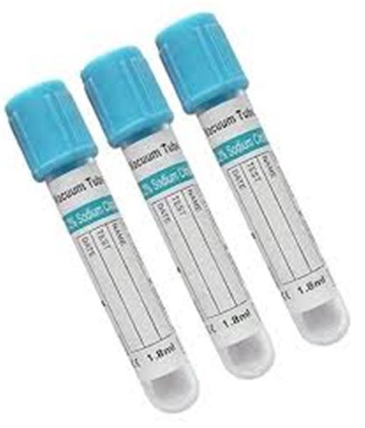 Serum Light Blue Top Edta Blood Test Tube Serum Separator