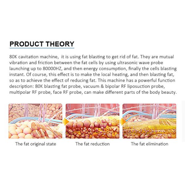 Прибор красоты удаления целлюлита RF 80K машины кавитации вакуума потери веса