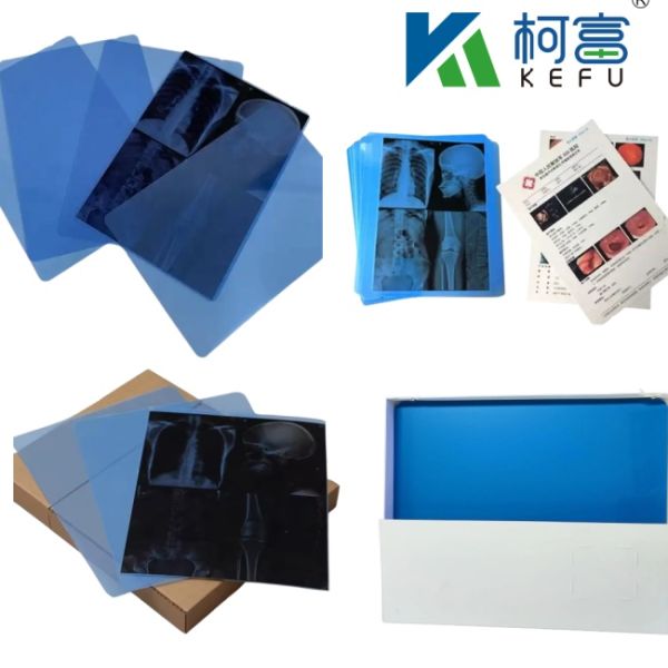 CT Scanner Dry X-ray A3 / A4 Medical Ink Jet Blue Film X-ray PET Film