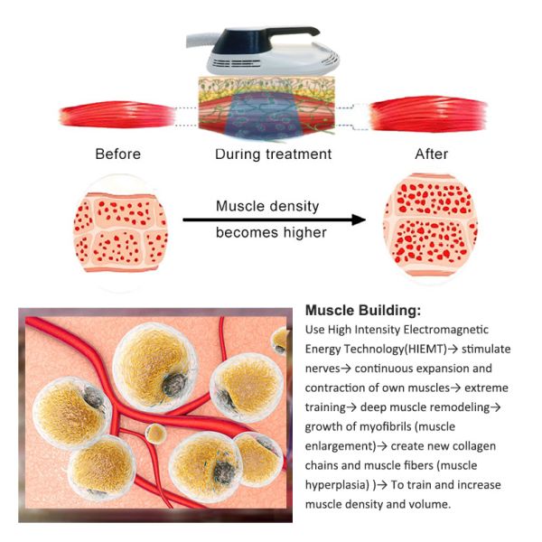 Beauty Device Portable Muscle Stimulator Equipment Body Sculpting Machine