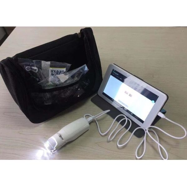 Отголосок - угол системы 20° цвета камеры дружелюбного Колпоскопе цифров электро