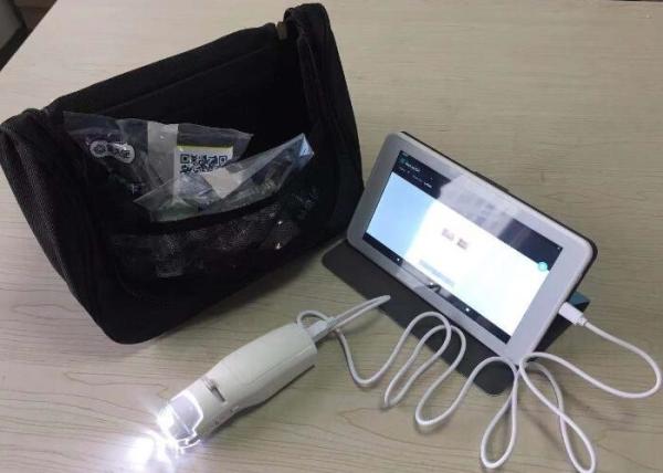 PAL Color System Vaginal Digital Electronic Colposcope Probe With AAA Batteries