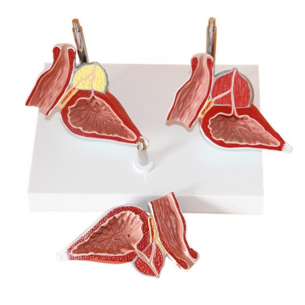 Human Anatomy PVC Simulation Human Pathology Prostate Model For Medical Educational