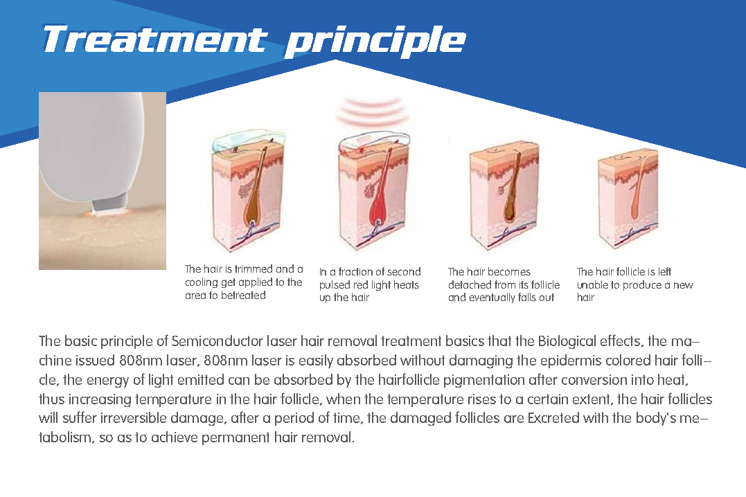 2018 new style advanced palomar vectus laser hair removal equipment with 808nm