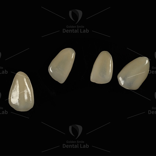 Translucency Emax Lithium Disilicate Veneers Ceramic Layered Emax Veneers