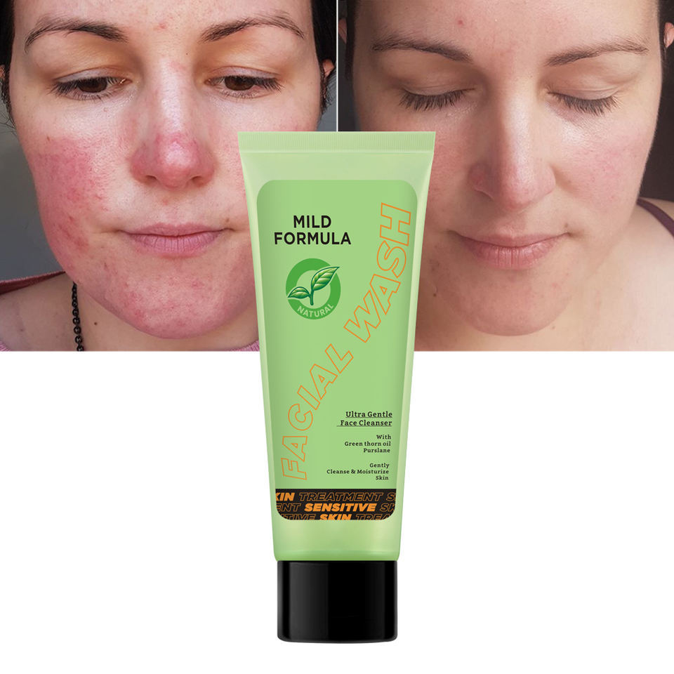 OEM ODM brand anti allergy moisturizing mild foam facial cleanser facial cleanser for sensitive skin