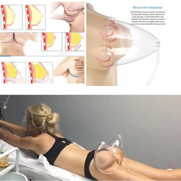 AURO Butt Lifting Breast Enhancement Machine 50Hz 60Hz Lymphatic Massage