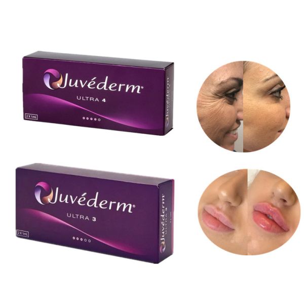 2 лет заполнителя Juvederm ультра 4 срока годности при хранении Hyaluronic кисловочного дермального