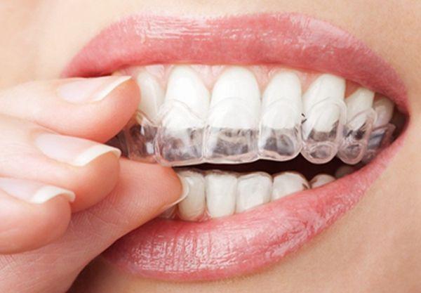 Super Anti Fouling Ability Stable Structure TPU Sheets Dental Foils Roll For Making Aligners