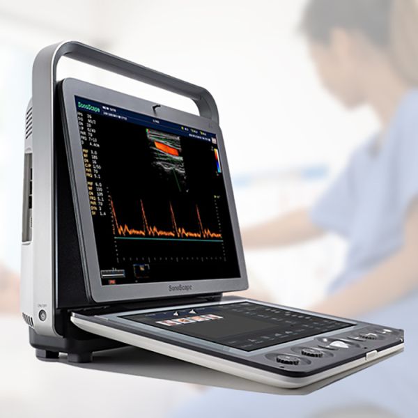 Sonoscape S9 Pregnant Baby Medical Diagnosis 4D Color Doppler Sonography Machine Portable Ultrasound