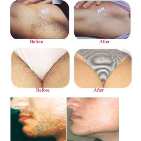 Подмолаживание кожи домашней машины удаления волос лазера Ipl 610nm пользы постоянное