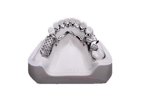 Easy To Clean Metal Frame Partial Denture Comfortable For Long Lasting Use